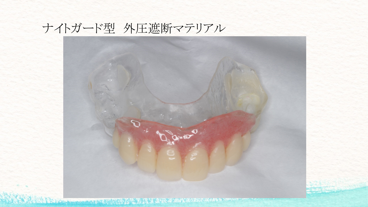 外圧遮断とGBR法を併用し上顎前歯部にインプラントを行った1症例