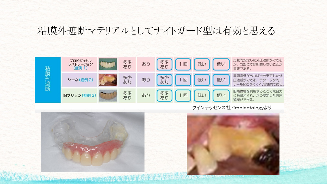 外圧遮断とGBR法を併用し上顎前歯部にインプラントを行った1症例